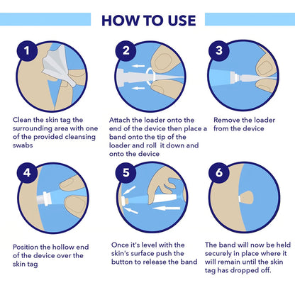 Skin Tag Removal Kit – At-Home Skin Tag Treatment